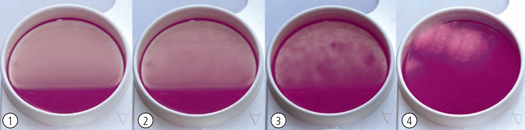 Kerba Test (CMT Test): bottiglia di reagente